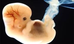 6 týždnove embryo.jpg - 
