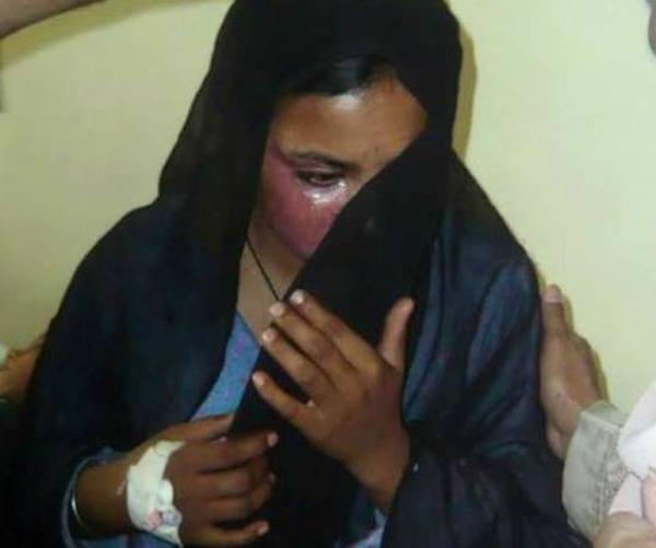 Pakistan: Christian woman set on fire after she refuses to convert, marry